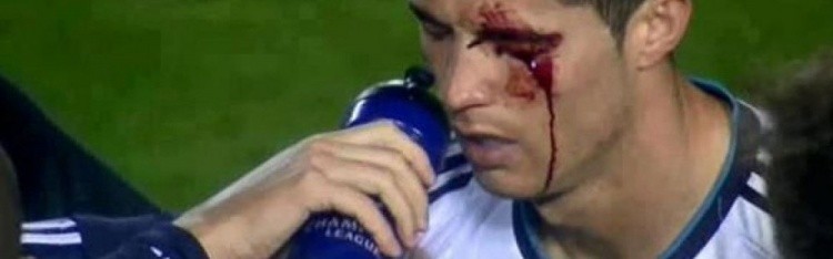 开云官方直播-莱万特旧将：我过去曾无意肘击C罗，媒体却几乎要把我关进监狱